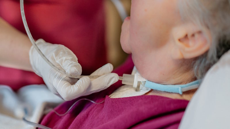 Medizinische Fachkraft mit Handschuhen versorgt eine ältere Patientin mit Tracheostoma und Beatmungsschlauch im Rahmen der intensivpflegerischen Behandlung.
